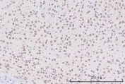 IHC staining of FFPE mouse brain tissue with RBM25 antibody. HIER: boil tissue sections in pH8 EDTA for 20 min and allow to cool before testing.