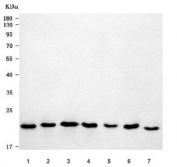 Western blot testing of 1) human HeLa, 2) human HepG2, 3) human Daudi, 4) human 293T, 5) rat liver, 6) rat PC-12 and 7) mouse liver tissue lysate with Pirh2 antibody. Predicted molecular weight: 21-30 kDa (multiple isoforms) with an additional possbile ~8 kDa isoform.