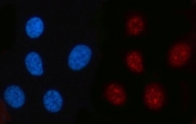 Immunofluorescent staining of FFPE human PC-3 cells with RFC2 antibody (red) and DAPI nuclear stain (blue). HIER: steam section in pH6 citrate buffer for 20 min.