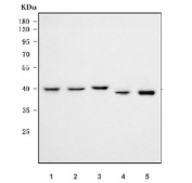 Western blot testing of 1) human HeLa, 2) human Jurkat, 3) human Daudi, 4) rat liver and 5) mouse liver tissue lysate with RFC3 antibody. Predicted molecular weight: 38-41 kDa.