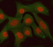 Immunofluorescent staining of FFPE human PC-3 cells with RFC3 antibody (red) and Alpha Tubulin mAb (green). HIER: steam section in pH6 citrate buffer for 20 min.