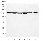 Western blot testing of 1) human HeLa, 2) human A549, 3) human HepG2, 4) human SiHa, 5) mouse small intestine and 6) mouse stomach tissue lysate with AP-B antibody. Predicted molecular weight ~73 kDa.