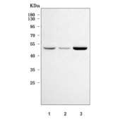 Western blot testing of human 1) HeLa, 2) HepG2 and 3) MCF7 cell lysate with Sphingosine kinase 1 antibody. Predicted molecular weight: ~43/51/44 kDa (isoforms 1/2/3).