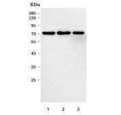 Western blot testing of human 1) HeLa, 2) 293T and 3) Daudi cell lysate with RBM14 antibody. Predicted molecular weight ~69 kDa.