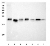 Western blot testing of 1) human T-47D, 2) human HEL, 3) human ThP-1, 4) rat testis, 5) rat lung, 6) mouse testis and 7) mouse lung tissue lysate with TMEM50B antibody. Predicted molecular weight ~18 kDa.