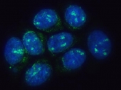 Immunofluorescent staining of FFPE human MCF7 cells with TMEM50B antibody (green) and DAPI nuclear stain (blue). HIER: steam section in pH6 citrate buffer for 20 min.