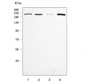 Western blot testing of 1) human HeLa, 2) human SiHa, 3) rat brain and 4) rat RH-35 cell lysate with Girdin antibody. Predicted molecular weight ~216 kDa.