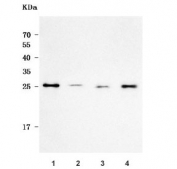 Western blot testing of human 1) U-87 MG, 2) Caco-2, 3) U-2 OS and 4) U-251 cell lysate with REP15 antibody. Predicted molecular weight ~27 kDa.