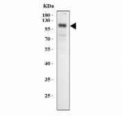 Western blot testing of human MCF7 cell lysate with RHBDF2 antibody. Predicted molecular weight ~97 kDa.
