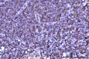 IHC staining of FFPE human tonsil tissue with RNF34 antibody. HIER: boil tissue sections in pH8 EDTA for 20 min and allow to cool before testing.