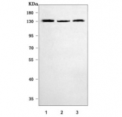 Western blot testing of human 1) 293T, 2) HeLa and 3) MCF7 cell lysate with RNF40 antibody. Predicted molecular weight ~114 kDa.