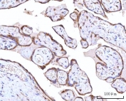 IHC staining of FFPE human placental tissue with RPN1 antibody. HIER: boil tissue sections in pH8 EDTA for 20 min and allow to cool before testing.