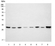 Western blot testing of 1) human HeLa, 2) human HepG2, 3) human MCF7, 4) human COLO-320, 5) rat liver, 6) rat pancreas, 7) mouse liver and 8) mouse pancreas tissue lysate with RPS4X/Y1/Y2 antibody. Predicted molecular weight ~30 kDa.