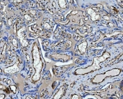 IHC staining of FFPE human placental tissue with TP53I13 antibody. HIER: boil tissue sections in pH8 EDTA for 20 min and allow to cool before testing.