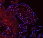 Immunofluorescent staining of FFPE human placental tissue with TP53I13 antibody (red) and DAPI nuclear stain (blue). HIER: boil tissue sections in pH8 EDTA for 20 min and allow to cool before testing.