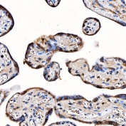 IHC staining of FFPE human placental tissue with TOP3B antibody. HIER: boil tissue sections in pH8 EDTA for 20 min and allow to cool before testing.