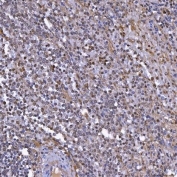 IHC staining of FFPE human spleen tissue with TOP3B antibody. HIER: boil tissue sections in pH8 EDTA for 20 min and allow to cool before testing.