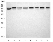 Western blot testing of 1) human K562, 2) human U-87 MG, 3) human U-251, 4) human 293T, 5) rat testis, 6) rat brain, 7) mouse testis and 8) mouse brain tissue lysate with TOP3B antibody. Predicted molecular weight: 80-97 kDa (multiple isoforms).
