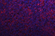 Immunofluorescent staining of FFPE human testis cancer with RPS15A antibody (red) and DAPI nuclear stain (blue). HIER: steam section in pH8 EDTA buffer for 20 min.
