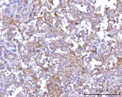 IHC staining of FFPE human testicular seminoma tissue with RPS15A antibody. HIER: boil tissue sections in pH8 EDTA for 20 min and allow to cool before testing.