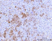 IHC staining of FFPE rat liver tissue with RPS25 antibody. HIER: boil tissue sections in pH8 EDTA for 20 min and allow to cool before testing.