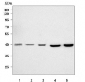Western blot testing of 1) human 293T, 2) human Jurkat, 3) human SH-SY5Y, 4) rat brain and 5) mouse brain tissue lysate with Tropomodulin 2 antibody. Predicted molecular weight ~40 kDa.