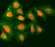 Immunofluorescent staining of FFPE human A549 cells with Tropomodulin 2 antibody (red) and Beta Tubulin mAb (green). HIER: steam section in pH6 citrate buffer for 20 min.