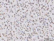 IHC staining of FFPE rat brain tissue with RPL11 antibody. HIER: boil tissue sections in pH8 EDTA for 20 min and allow to cool before testing.