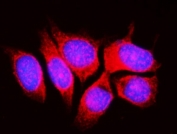 Immunofluorescent staining of FFPE human MCF7 cells with RPL11 antibody (red) and DAPI nuclear stain (blue). HIER: steam section in pH6 citrate buffer for 20 min.