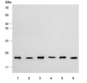 Western blot testing of 1) human A549, 2) human Jurkat, 3) human Raji, 4) human HeLa, 5) mouse liver and 6) mouse NIH 3T3 cell lysate with RPL11 antibody. Predicted molecular weight ~18 kDa.
