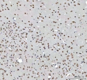 IHC staining of FFPE mouse brain tissue with RTCB antibody. HIER: boil tissue sections in pH8 EDTA for 20 min and allow to cool before testing.