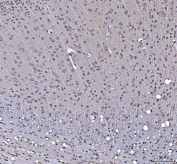 IHC staining of FFPE rat brain tissue with RTCB antibody. HIER: boil tissue sections in pH8 EDTA for 20 min and allow to cool before testing.