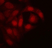 Immunofluorescent staining of FFPE human HeLa cells with RTCB antibody (red). HIER: steam section in pH6 citrate buffer for 20 min.