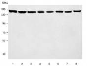Western blot testing of 1) human HeLa, 2) human HepG2, 3) human PC-3, 4) rat brain, 5) rat testis, 6) rat C6, 7) mouse brain and 8) mouse testis tissue lysate with RTEL1 antibody. Predicted molecular weight ~134 kDa.