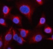 Immunofluorescent staining of FFPE human A549 cells with OCRL-1 antibody (red) and DAPI nuclear stain (blue). HIER: steam section in pH6 citrate buffer for 20 min.