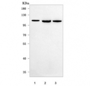 Western blot testing of human 1) SH-SY5Y, 2) 293T and 3) HeLa cell lysate with OCRL-1 antibody. Predicted molecular weight ~104 kDa.