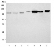 Western blot testing of 1) human HeLa, 2) human HepG2, 3) human Daudi, 4) rat lung, 5) rat heart, 6) mouse lung and 7) mouse heart tissue lysate with OGDH antibody. Predicted molecular weight ~116 kDa.