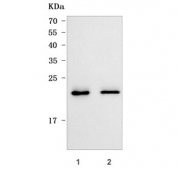 Western blot testing of human 1) 293T and 2) K562 cell lysate with OIP5 antibody. Predicted molecular weight ~25 kDa.