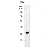 Western blot testing of human U-2 OS cell lysate with OLAH antibody. Predicted molecular weight ~30 kDa and ~36 kDa (two isoforms).