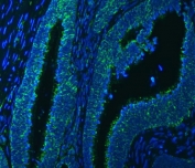 Immunofluorescent staining of FFPE human colon cancer tissue with SSBP1 antibody (green) and DAPI nuclear stain (blue). HIER: steam section in pH8 EDTA buffer for 20 min.