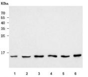 Western blot testing of human 1) HeLa, 2) 293T, 3) MOLT-4, 4) K562, 5) A549 and 6) A375 cell lysate with SSBP1 antibody. Predicted molecular weight ~17 kDa.