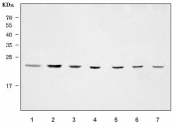 Western blot testing of 1) human Jurkat, 2) human HepG2, 3) human COLO-320, 4) rat liver, 5) rat RH35, 6) mouse liver and 7) mouse HEPA1-6 cell lysate with SSR2 antibody. Expected molecular weight: 20-22 kDa.