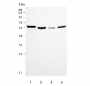 Western blot testing of 1) human HeLa, 2) rat C6, 3) mouse testis and 4) mouse NIH 3T3 cell lysate with PATL2 antibody. Predicted molecular weight ~61 kDa.