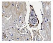 IHC staining of FFPE human esophagus tissue with GSDMD antibody. HIER: boil tissue sections in pH8 EDTA for 20 min and allow to cool before testing.
