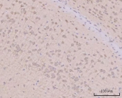 IHC staining of FFPE mouse brain tissue with PITPNB antibody. HIER: boil tissue sections in pH8 EDTA for 20 min and allow to cool before testing.