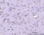 IHC staining of FFPE rat brain tissue with PITPNB antibody. HIER: boil tissue sections in pH8 EDTA for 20 min and allow to cool before testing.