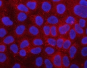 Immunofluorescent staining of FFPE human HL60 cells with PLC-delta-3 antibody (red) and DAPI nuclear stain (blue). HIER: steam section in pH6 citrate buffer for 20 min.