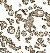 IHC staining of FFPE human placental tissue with COL4A3 antibody. HIER: boil tissue sections in pH8 EDTA for 20 min and allow to cool before testing.