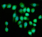 Immunofluorescent staining of FFPE human SiHa cells with KIF2A antibody (green) and DAPI nuclear stain (blue). HIER: steam section in pH6 citrate buffer for 20 min.