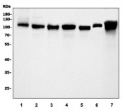 Western blot testing of 1) human HeLa, 2) human HepG2, 3) monkey COS-7, 4) human K562, 5) rat NRK, 6) mouse lung and 7) mouse NIH 3T3 cell lysate with KIF2A antibody. Predicted molecular weight ~80 kDa, commonly observed at 80-110 kDa.